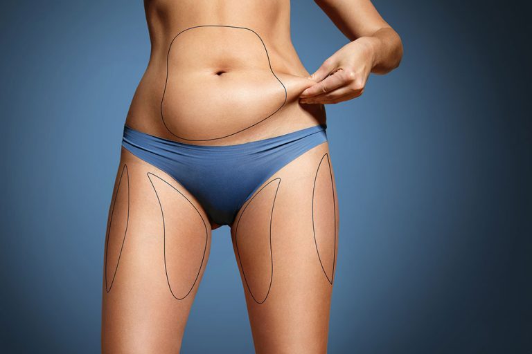 Antalya Liposuction Turkey