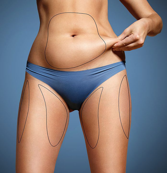 liposuction in turkey and liposuction in antalya