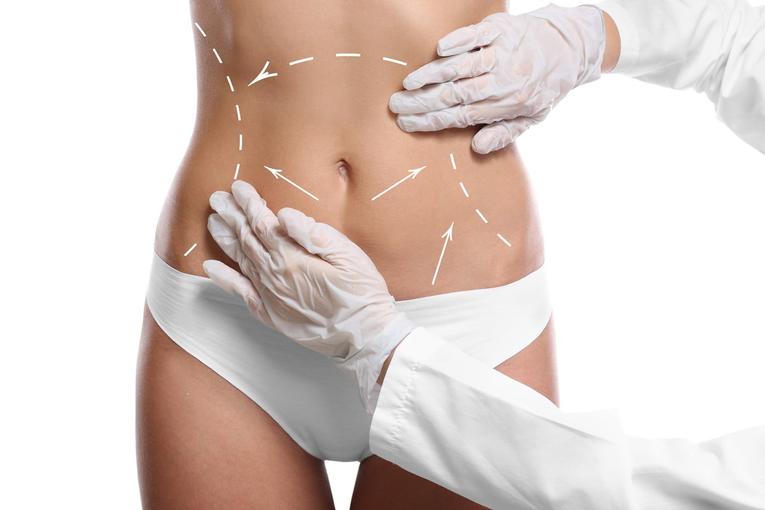 ABDOMINAPLASTY IN TURKEY