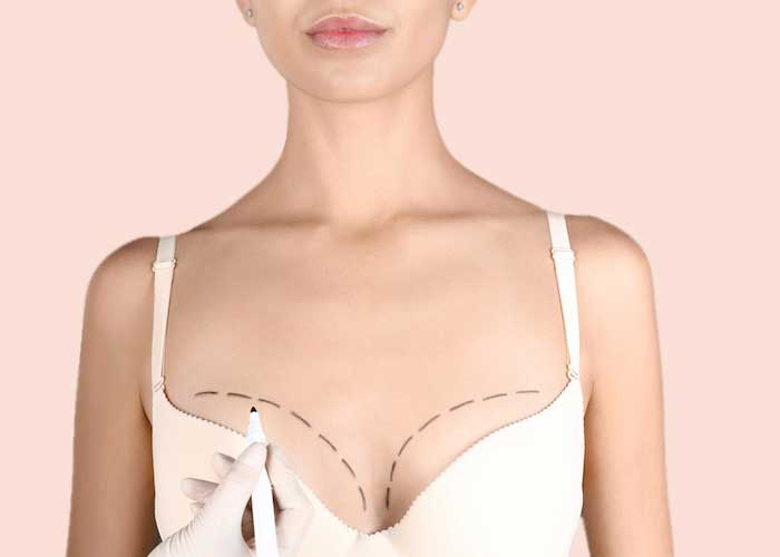 breast lift in turkey antalya