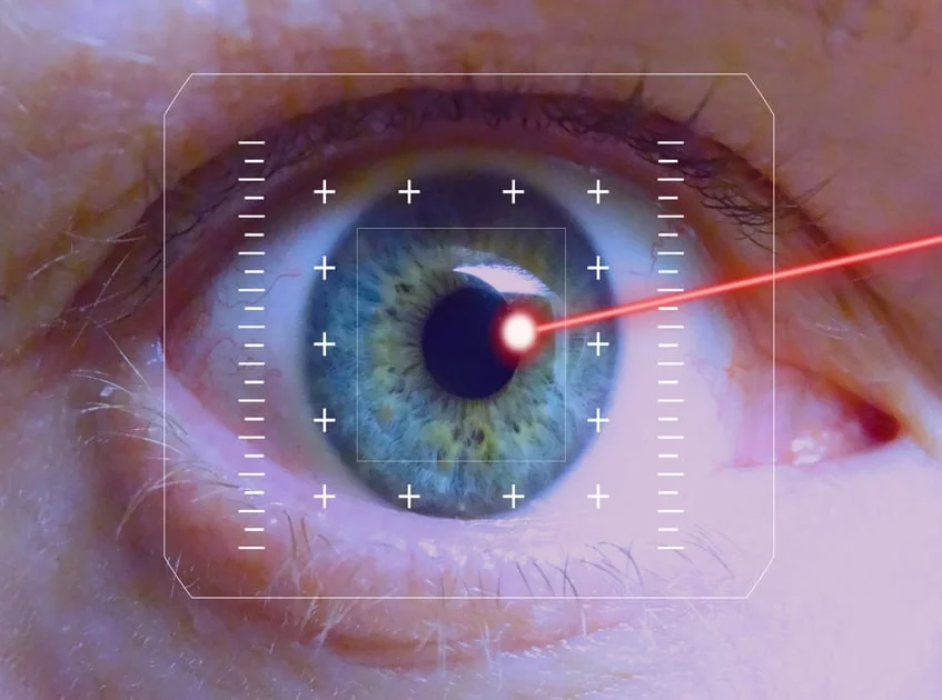 laser eye surgery turkey