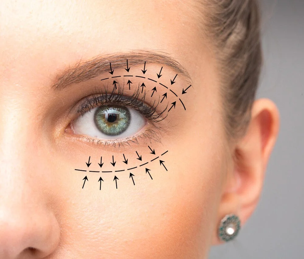 eyelid surgery