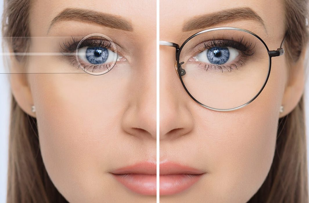 woman after eye surgery