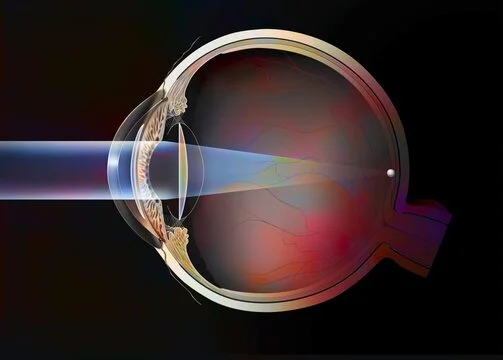 how does lens replacement works on a eye