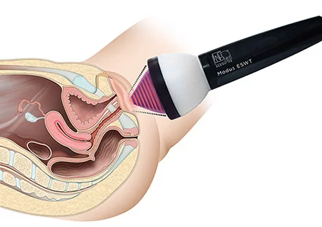 vaginismus treatment antalya