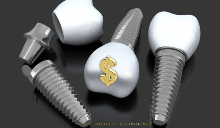Why Dental Implants So Expensive? Affordable Teeth Implants Option