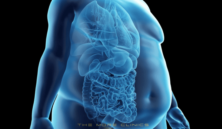 Antalya Gastric bypass surgery