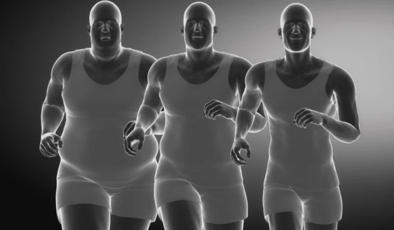Ultimate Guide for Gastric Sleeve Surgery in Turkey