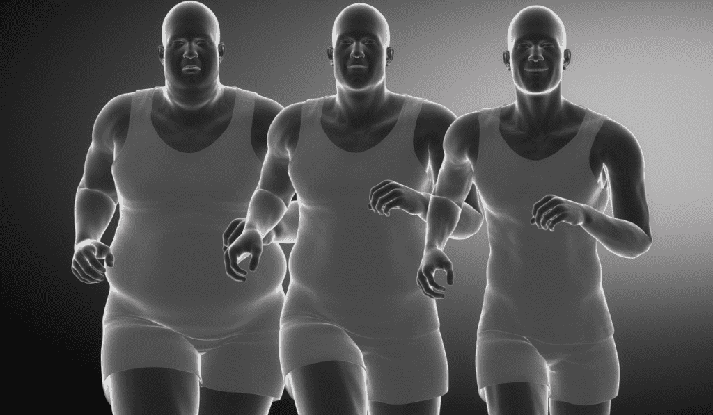 Gastric Sleeve in Turkey Guide The More Clinics