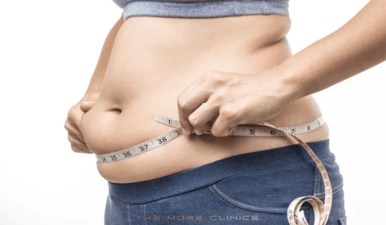 Non-Surgical Weight Loss Procedures