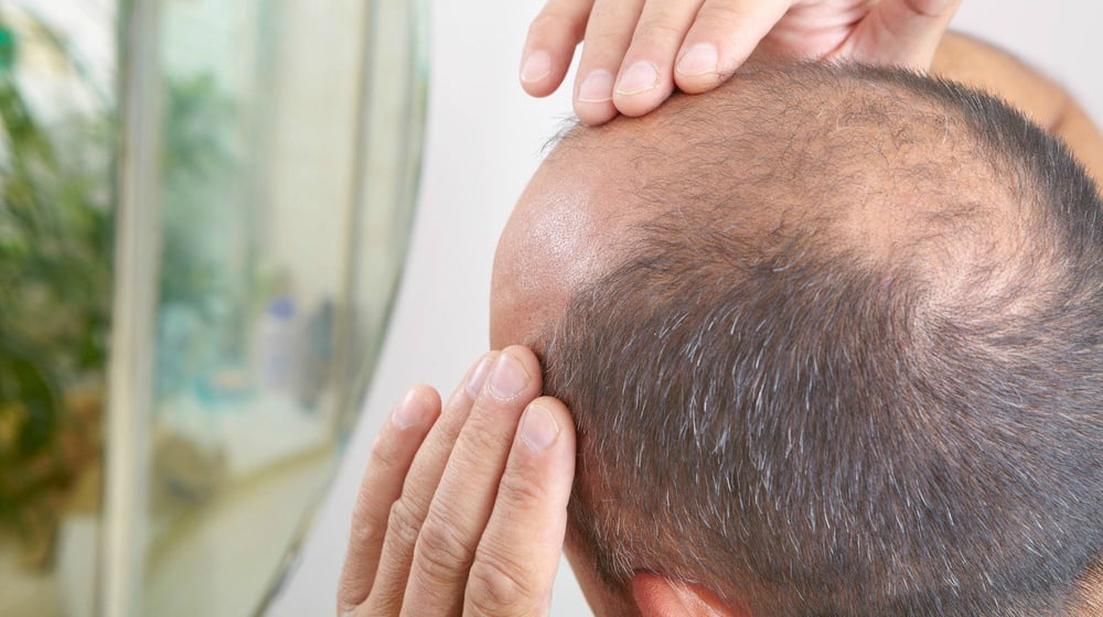 stem cell for hair loss