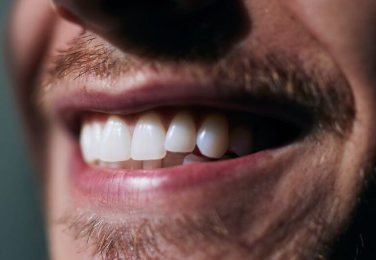 Holistic Dental Care Turkey