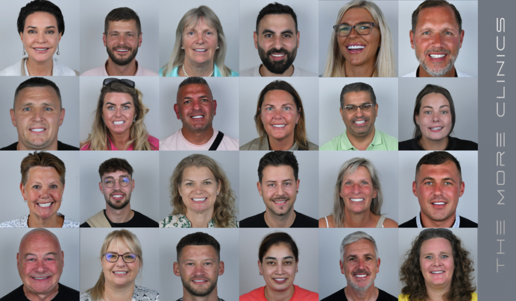 399 dental implants before and after