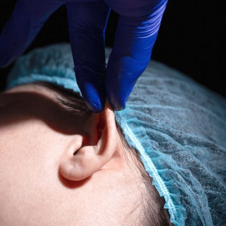 otoplasty turkey
