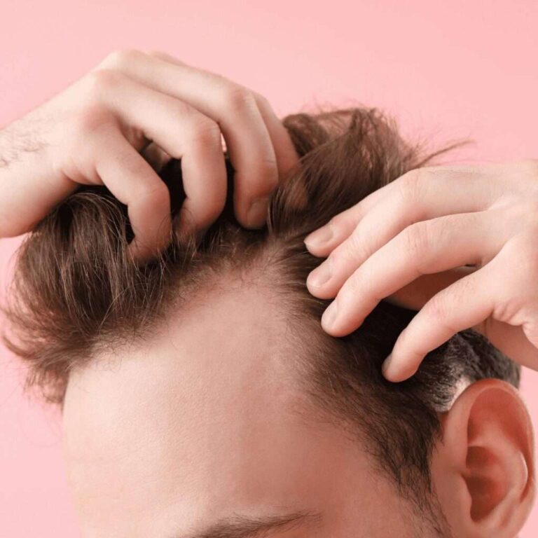 Antalya Hair Transplant