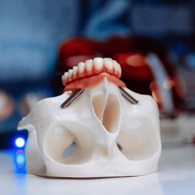 Oral and Maxillofacial Surgeons: Masters of Oral and Facial Care