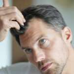 Antalya Fue Hair Transplant