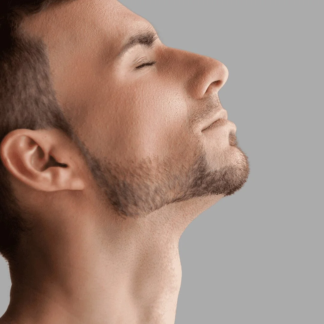 beard transplant before and after men