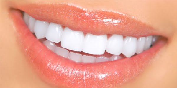 dental veneers as a part of smile design
