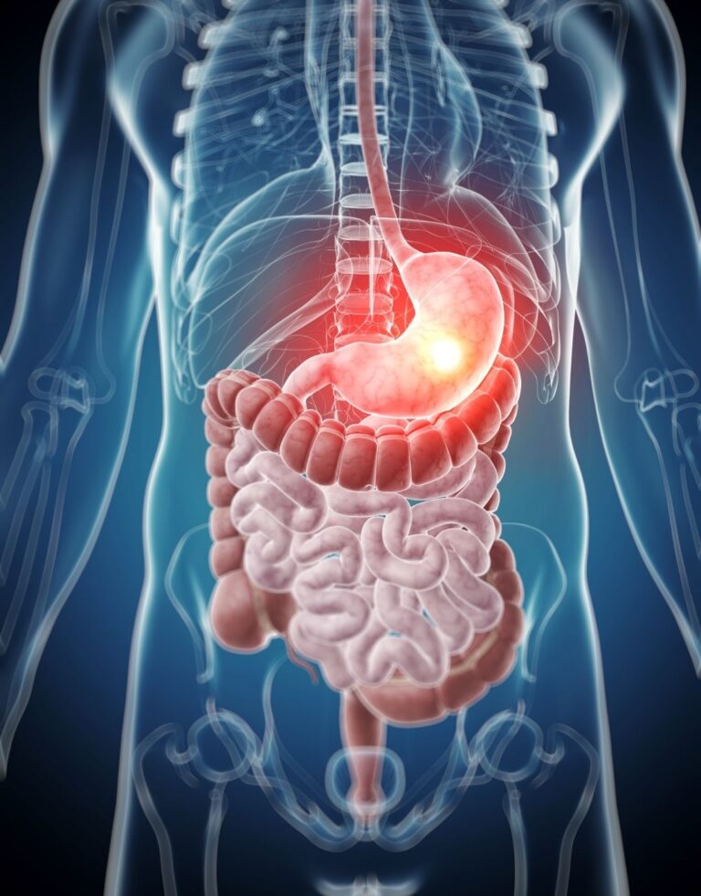 gastric sleeve surgery Turkey