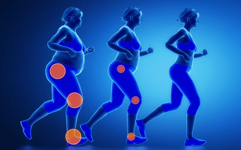 gastric bypass recovery timeline