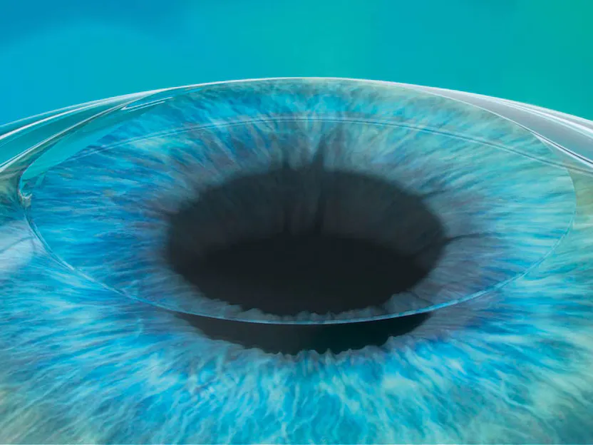 long term care of your ilasik eye laser turkey antalya