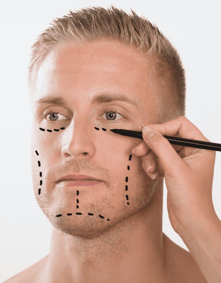 Antalya plastic Surgery for men
