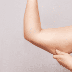 Antalya Arm Lift