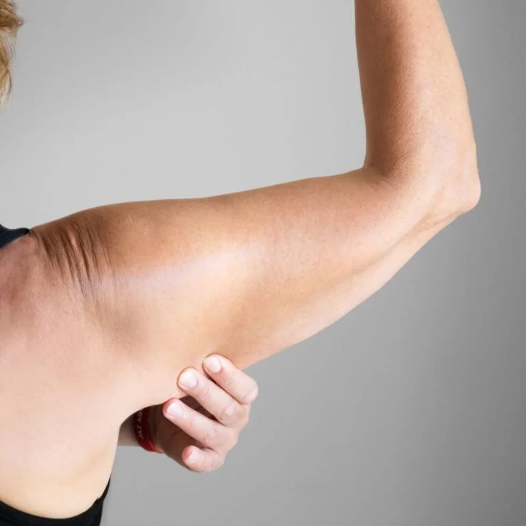 Brachioplasty Arm Lift Guide: All You Need to Know