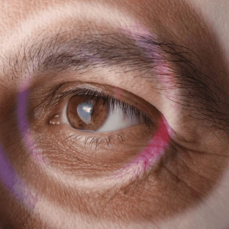 10 Common Myths About Cataract Surgery