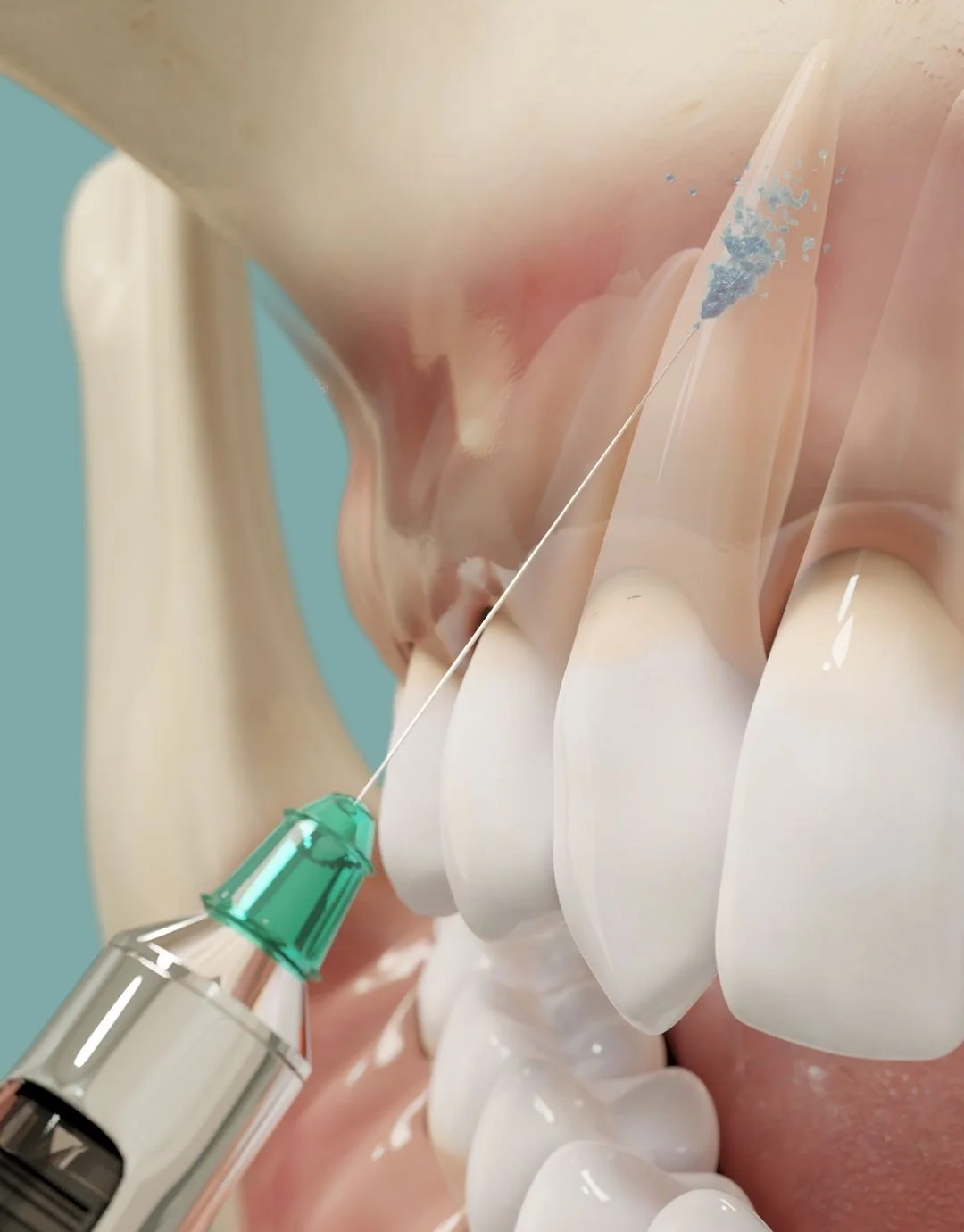 what is anesthesia and types