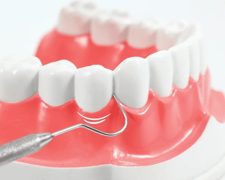 how is pocket reduction (flap surgery) treatment is done to treat periodontal disease