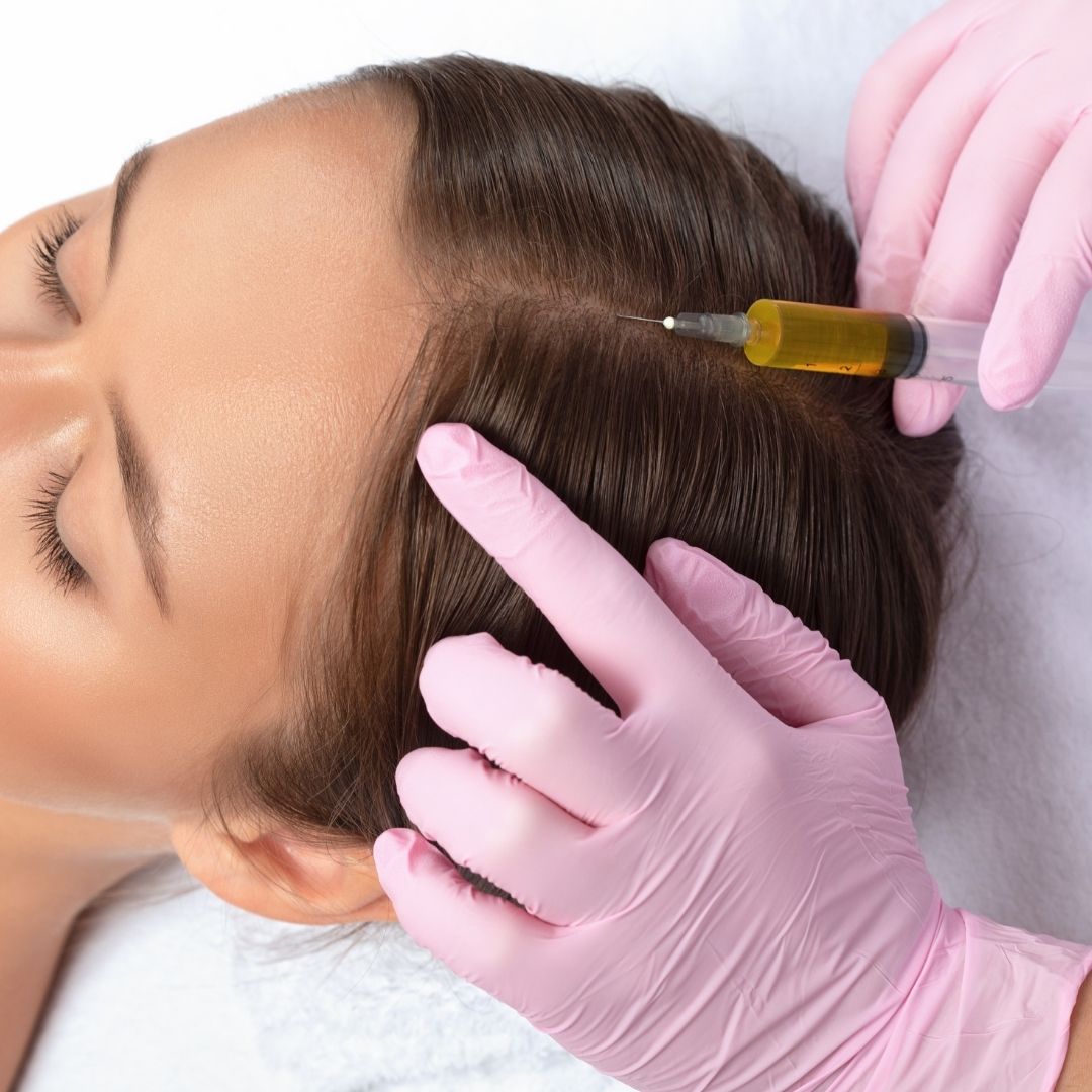 prp injection for hair loss