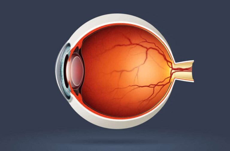 Retinal Detachment Causes & Symptoms & Treatment