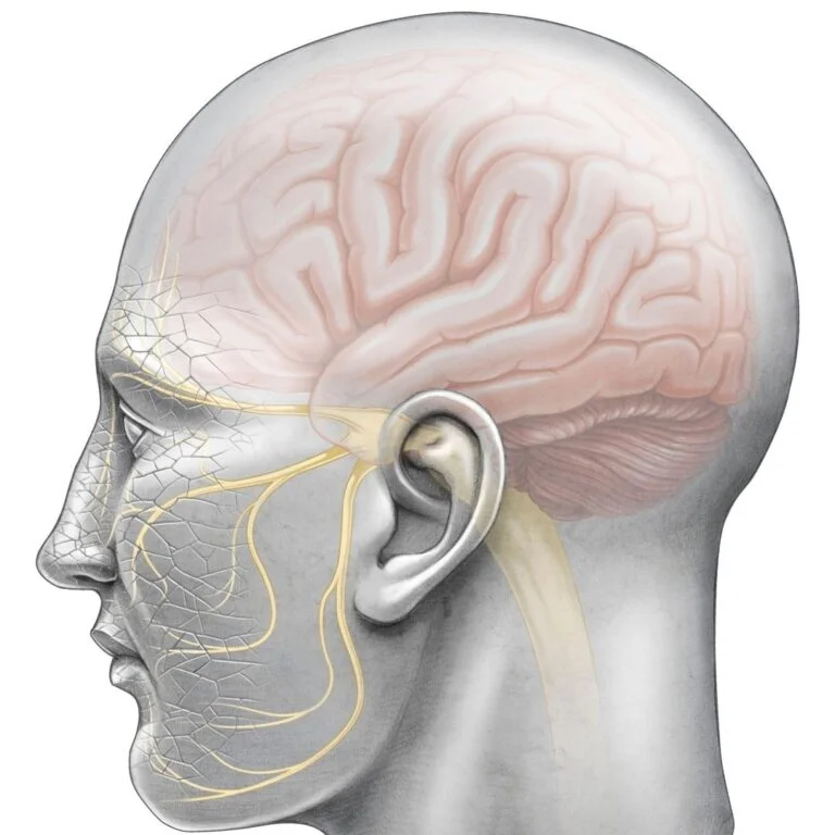 Nerve Repositioning (Lateralization)