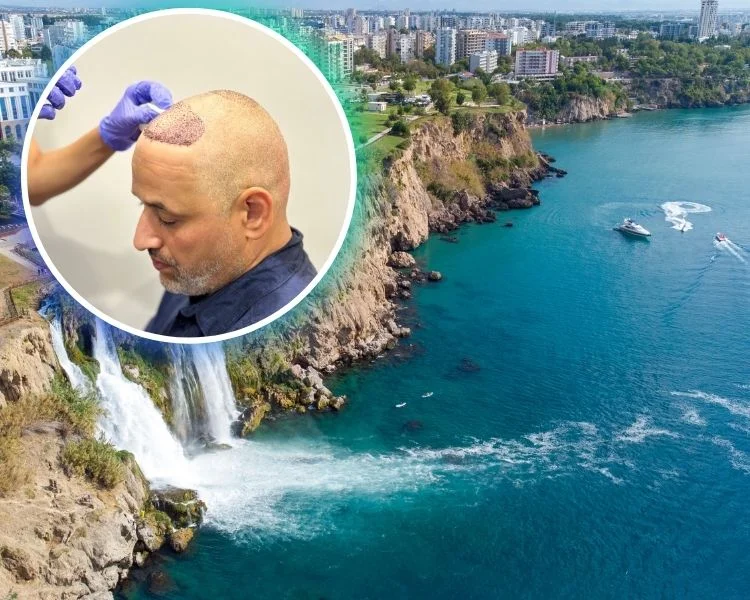 Haartransplantation Antalya: Kosten & Erfahrungen
