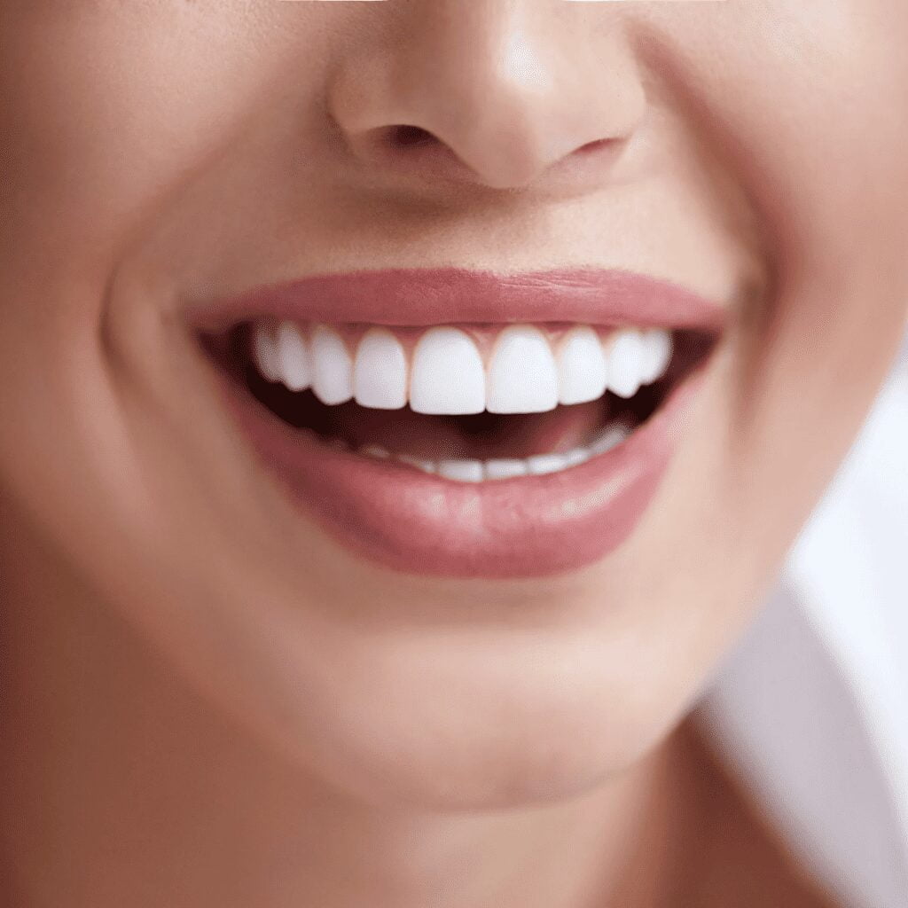 Antalya Smile Makeover