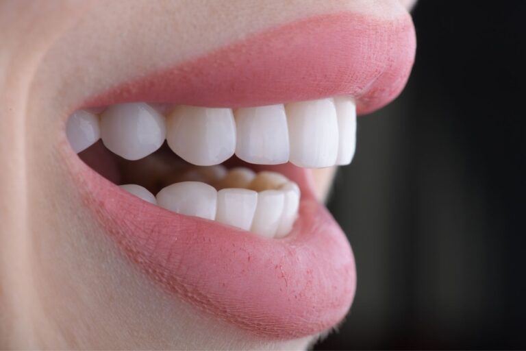 antalya zirconium crowns