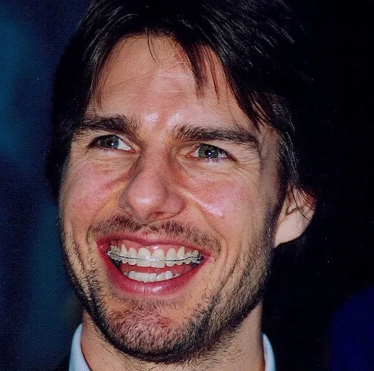 Tom Cruise Teeth Before