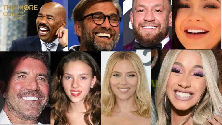 Top Celebrities with Veneers That Transformed Their Smiles