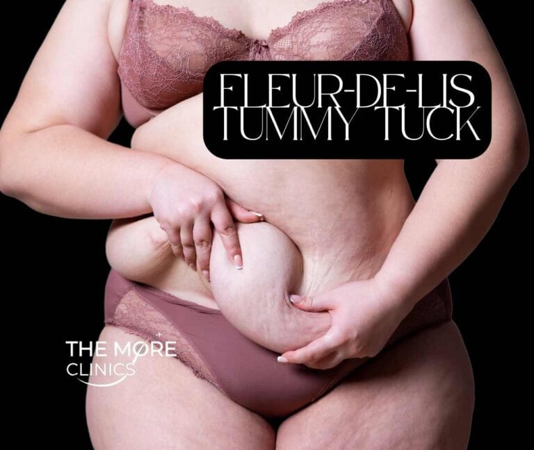 fleur de lis abdominoplasty turkey candidate