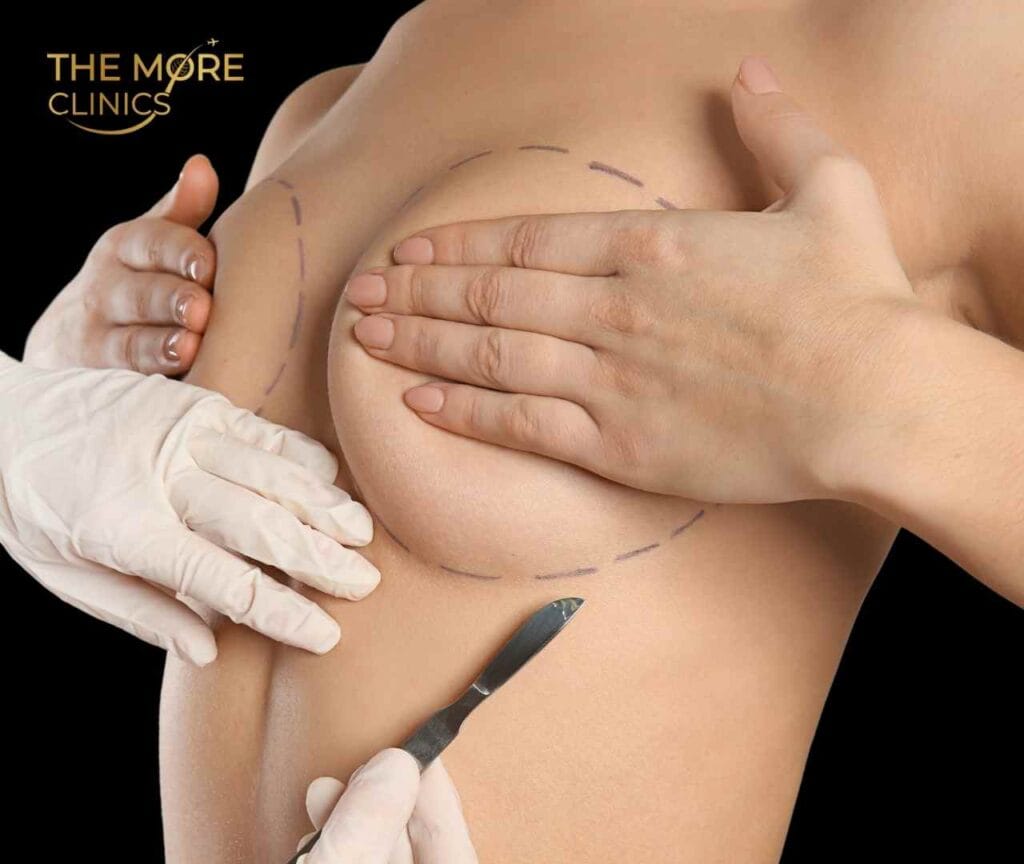 mejor lugar en turquía para el aumento de pecho