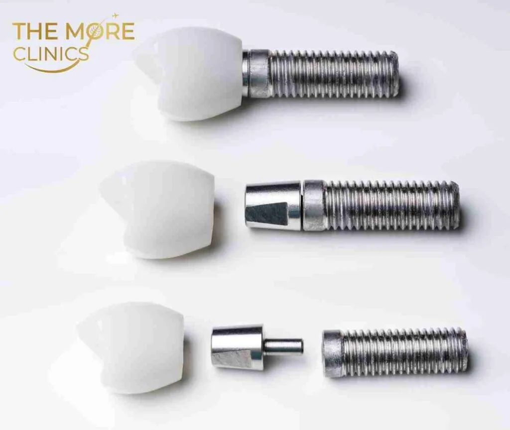 dental implants turkey teeth with screw, abutment and implant crown