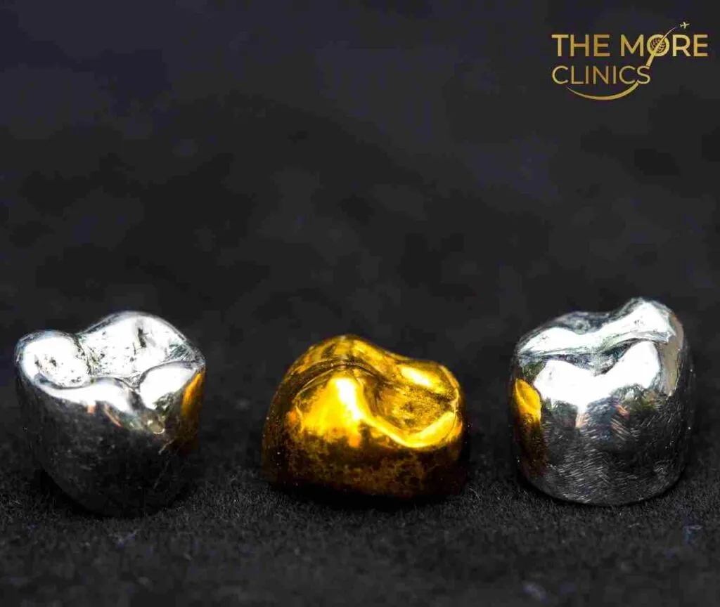 gold types of dental crowns and cost