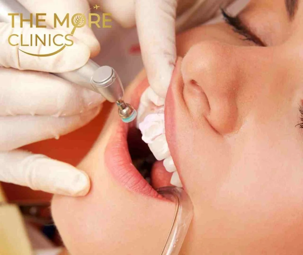 procedure crown lenghtening for crown