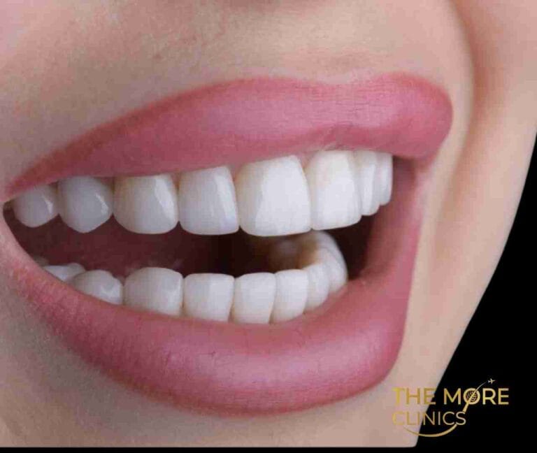 porzellan krone​ zahne