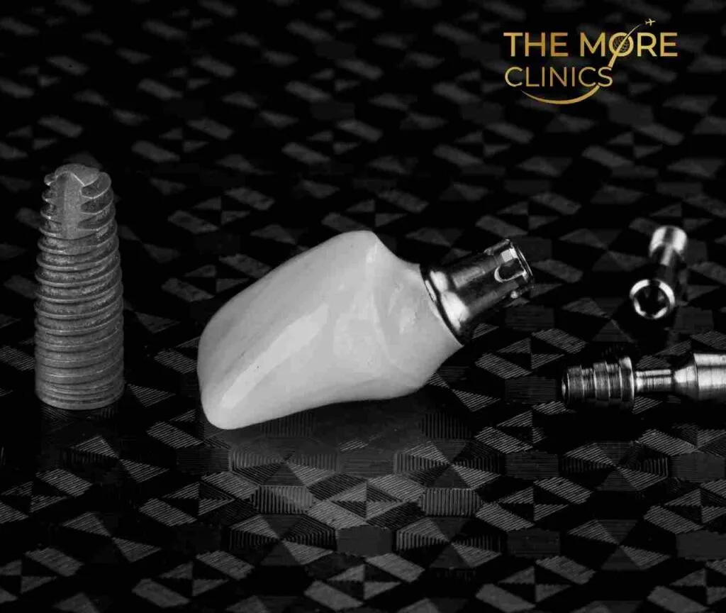 turkey teeth implants stages