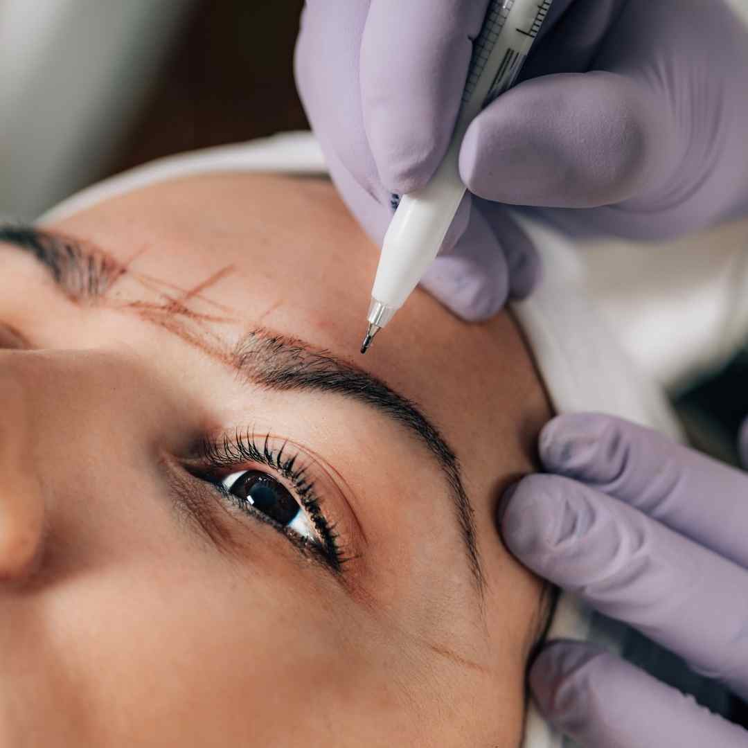 Augenbrauen Lifting Kosten