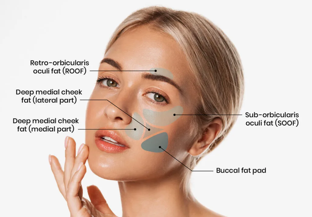 what is buccal fat pad removal