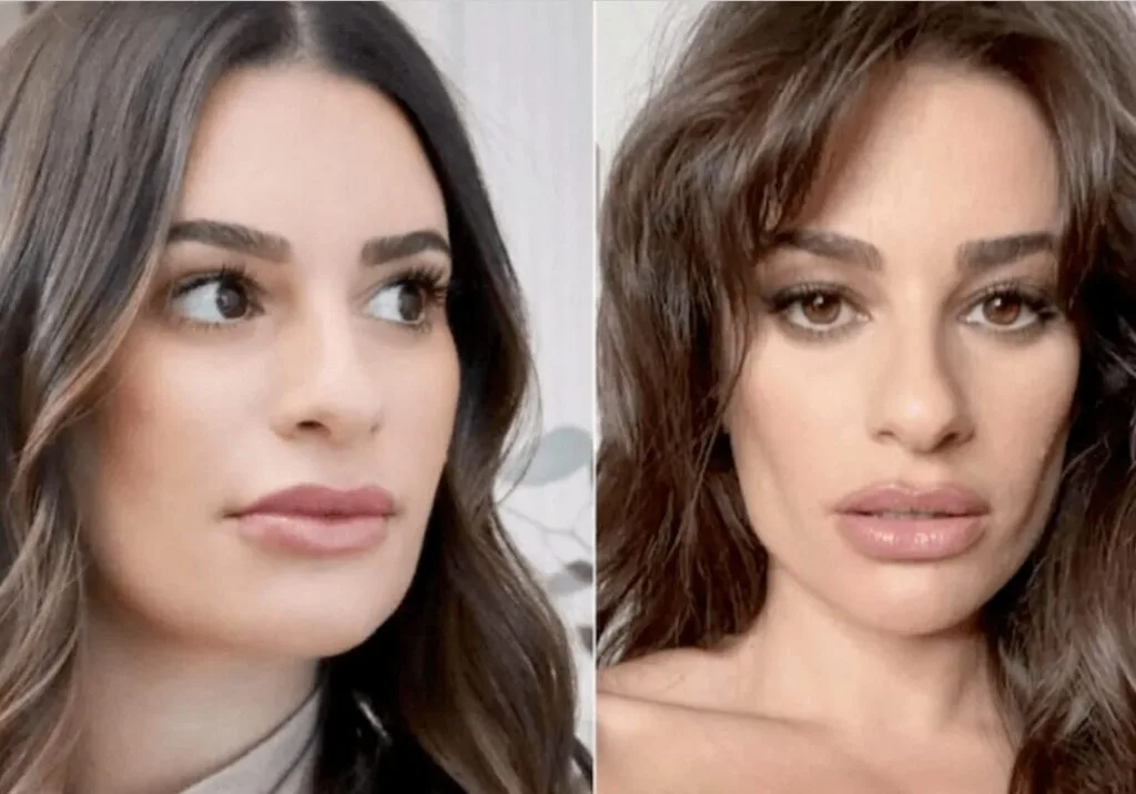buccal fat removal before and after lea michele